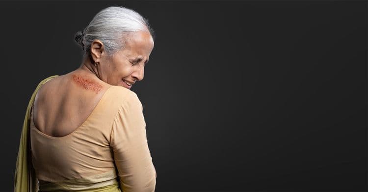 Shingles : ‘नागीणीने विळखा मारल्यास जीव जातो’ ही निव्वळ अंधश्रद्धा!
