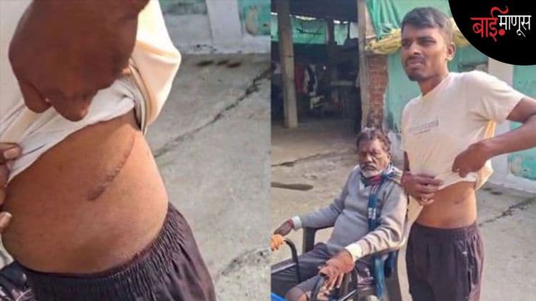 रोशन कुडे किडनी प्रकरणातून समोर आले आंतरराष्ट्रीय रॅकेट;
आतापर्यंत 12 जणांची किडनी विक्री....